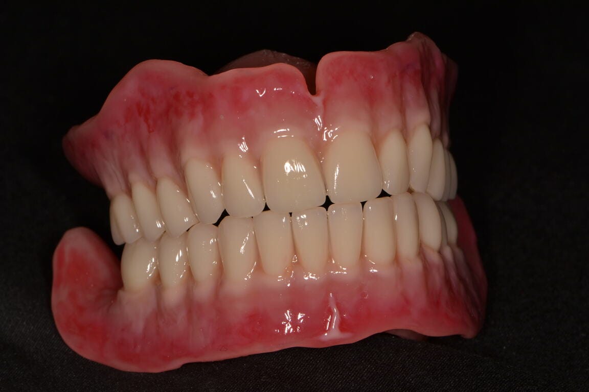 Perfect-dental celkové náhrady