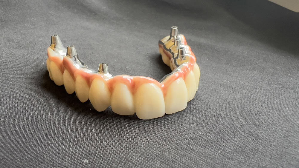 Perfect-dental můstky