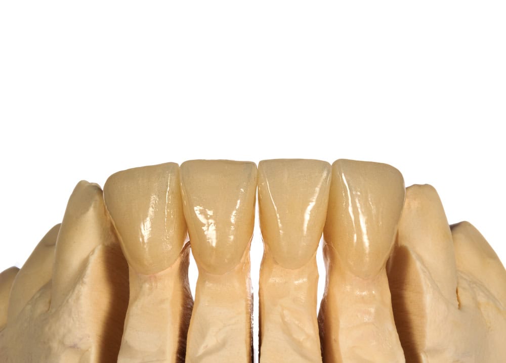 Perfect-dental korunky