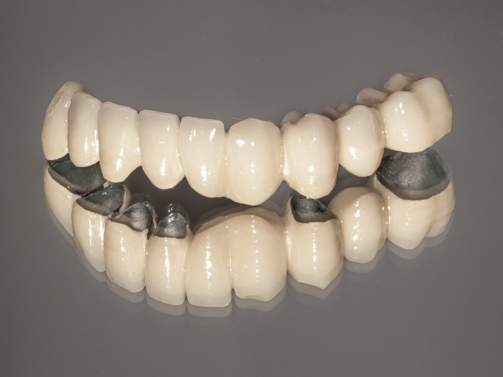 Perfect-dental zasuvne spoje